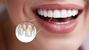 Implante Dentário em João Pessoa: Como Funciona, Quanto Custa e Quando Vale a Pena